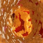 کاهش ۵۸ درصدی کلسترول بد با یک داروی جدید