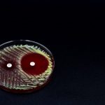 نانوژل‌های ضدباکتری: راهی برای مقابله با عفونت‌های مقاوم