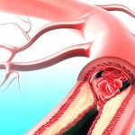 دارویی که همزمان با بیماری قلبی و دیابت مقابله می‌کند