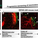 آلزایمر با تخریب عصب‌ها در بافت چربی، فراتر از مغز اثر می‌گذارد