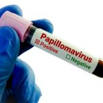 واکسن پاپیلومای انسانی؛ پیشگیری موثر از سرطان دهانه رحم