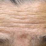 ترکیب فناوری نانو و زیست‌فناوری برای جوان‌سازی طبیعی و ماندگار پوست