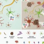 تشدید آلزایمر و نقش بازدارنده ترکیبات معطر گیاهی برای مقابله